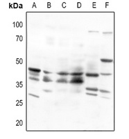 Beta-3 Adrenergic Receptor Rabbit Polyclonal Antibody