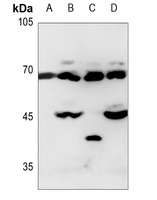 Alpha-fetoglobulin Antibody