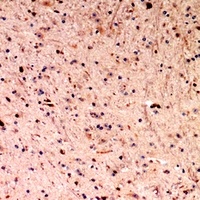 Alpha-fetoglobulin Antibody