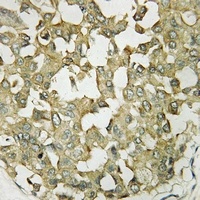 Anti-APJ Antibody