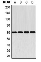 AKT Rabbit Polyclonal Antibody