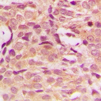 AKT Rabbit Polyclonal Antibody