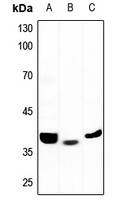 ALDOB Antibody