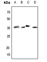 Aldose Reductase Antibody