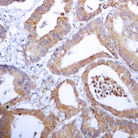 Aldose Reductase Antibody