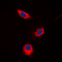 Aldose Reductase Antibody