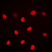 Anti-ALX3 Antibody