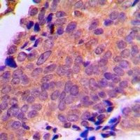 ANT3 Antibody