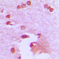 Anti-APBA2 Antibody