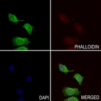 Anti-APBA2 Antibody
