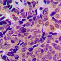 Anti-Beta Amyloid (Phospho-T743) Antibody