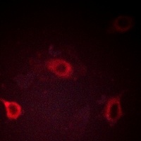 Anti-Beta Amyloid (Phospho-T743) Antibody