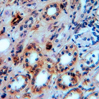 Anti-Aquaporin 1 Antibody