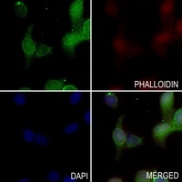Anti-Aquaporin 1 Antibody