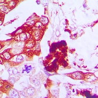 Aquaporin 3 Rabbit Polyclonal Antibody