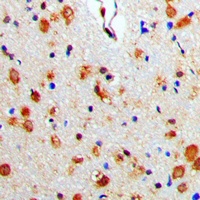 Anti-Beta-arrestin-1 Antibody