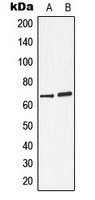 Arylsulfatase D Antibody
