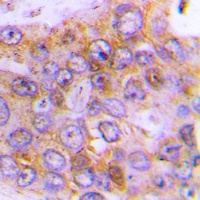 Anti-Arylsulfatase D Antibody