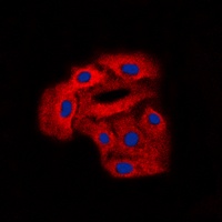 Anti-Arylsulfatase D Antibody