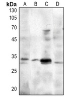 MASH1 Rabbit Polyclonal Antibody