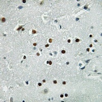 MASH1 Rabbit Polyclonal Antibody