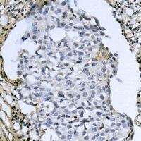 Anti-ATF4 (Phospho-S245) Antibody