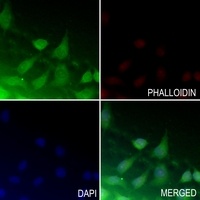 Anti-ATF4 (Phospho-S245) Antibody
