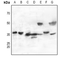 CD298 Rabbit Polyclonal Antibody