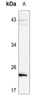 BAD (Phospho-S136) Antibody