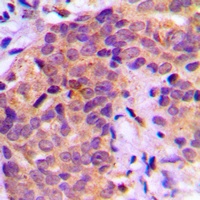BAD (Phospho-S136) Antibody