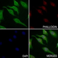 Anti-BARD1 Antibody
