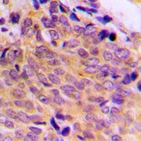 Anti-BAX Antibody