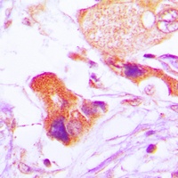 Anti-BCL2 (Phospho-S70) Antibody