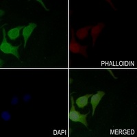 Anti-BCL2 (Phospho-S70) Antibody