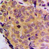 Anti-BCLW Antibody