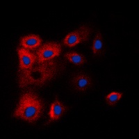 Anti-BCLW Antibody