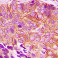 Anti-BIK (Phospho-T33) Antibody