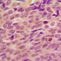 BRCA1 (Phospho-S1524) Antibody