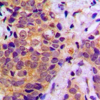 B-RAF Rabbit Polyclonal Antibody