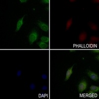 Anti-BTK (Phospho-Y223) Antibody
