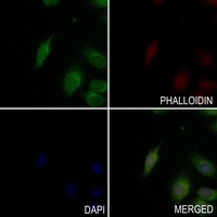 BTK antibody