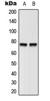 BTK (Phospho-Y551) Antibody