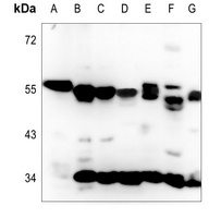 Calreticulin Rabbit Polyclonal Antibody