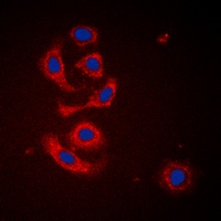 CALR antibody