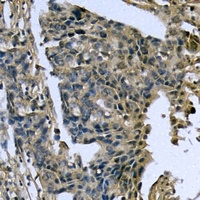 Anti-Caspase 4 Antibody