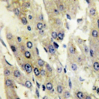 Anti-Catalase (Phospho-Y386) Antibody