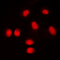 Anti-RUNX1 Antibody