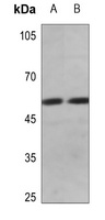 Cyclin E1 (Phospho-T395) Antibody