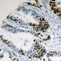 Cyclin E1 (Phospho-T395) Antibody