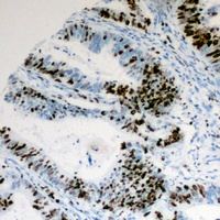 CCNE1 antibody